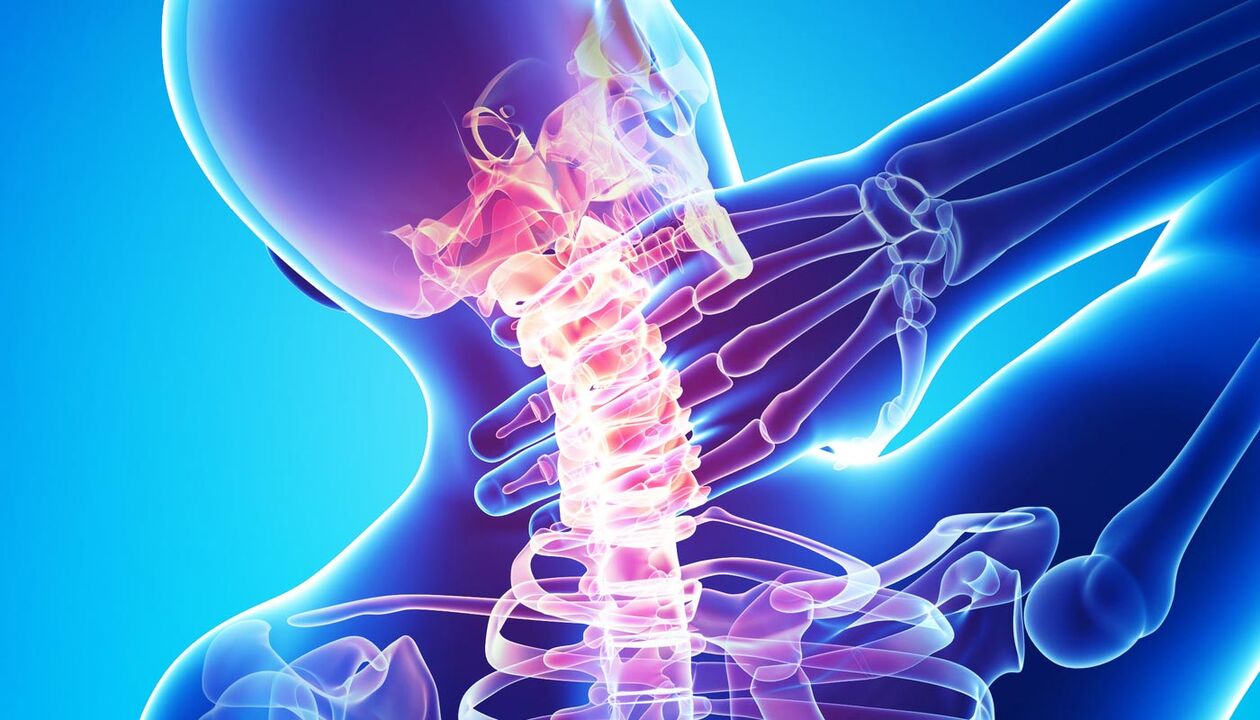 osteokondroosist tingitud kaelavalu