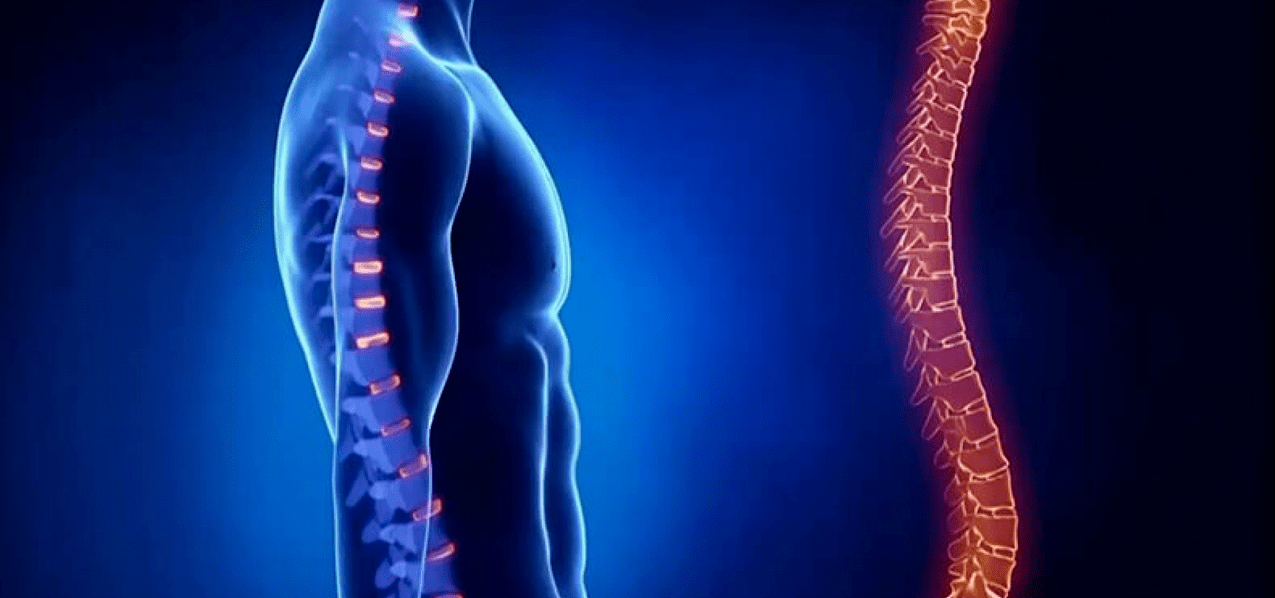 osteokondroosist tingitud selgroo kahjustused